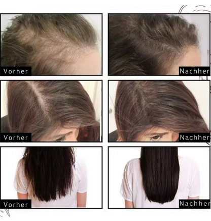 Das Haarwunder mit Schwarzkümmel, Rosmarin & Zwiebel